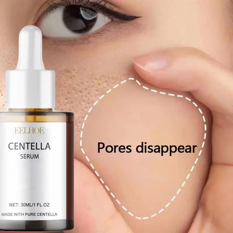 Luxury Skincare Korea - Sérum Facial de Centella Asiática para