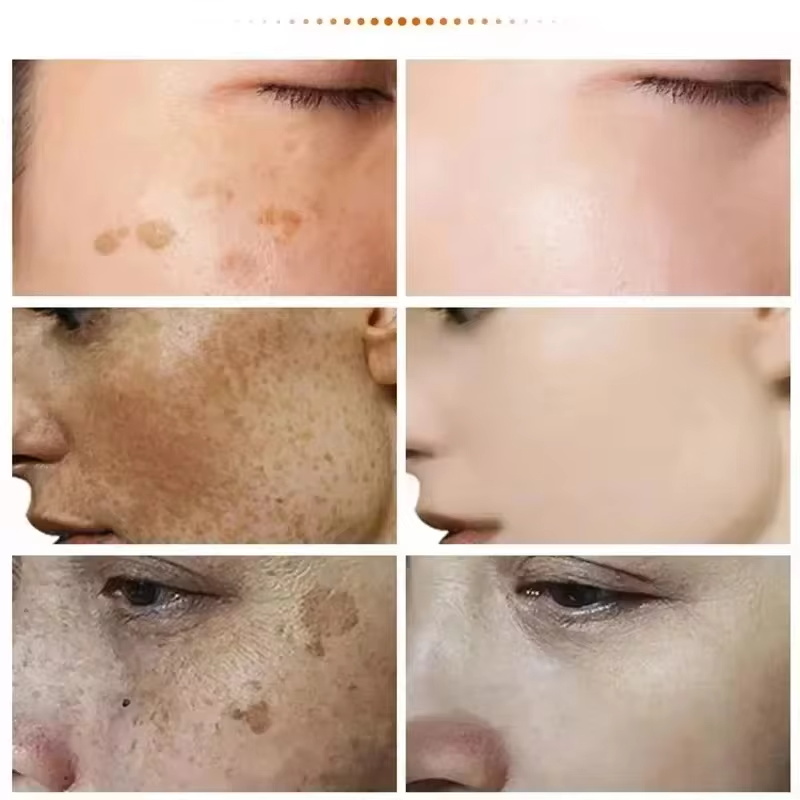 Poderosa creme de clareamento  - Luxury Skincare Brands avaliação e preço