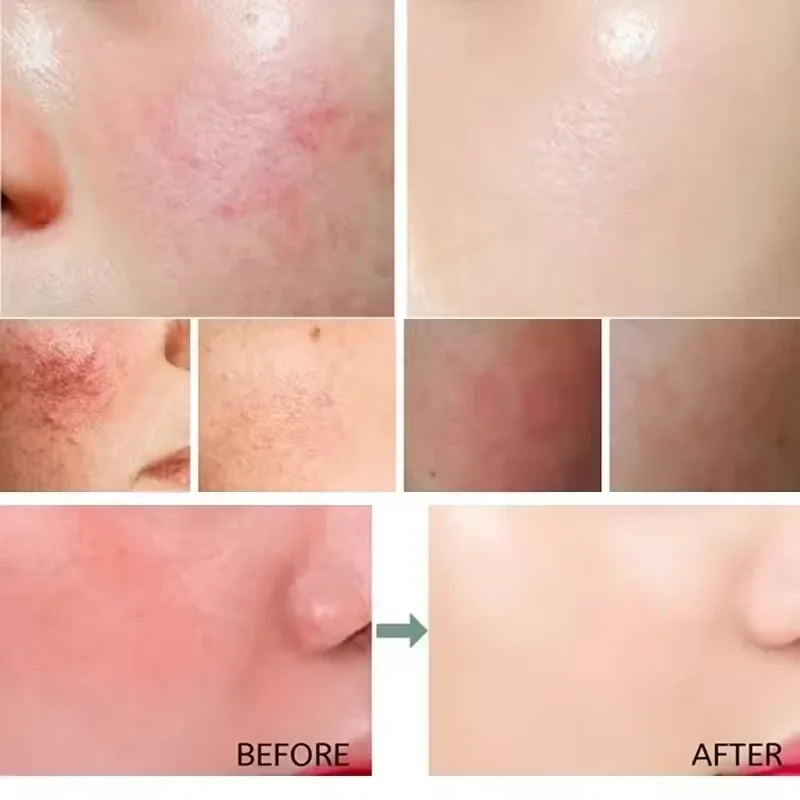 Creme reparador de vermelhidão - Luxury Skincare Brands avaliação e preço