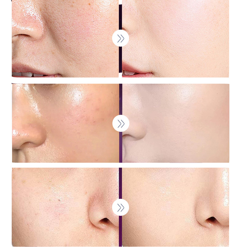 Luxo nobre senhora pérola bran - Luxury Skincare China avaliação e preço
