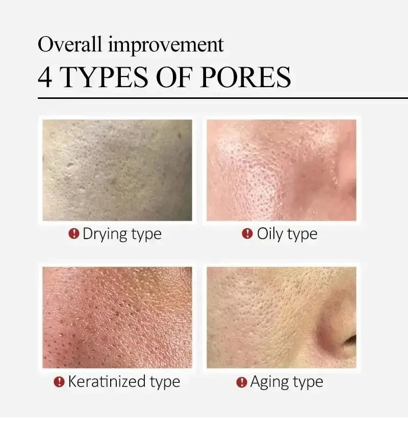 Sérum Facial de Centella Asiát - Luxury Skincare Korea avaliação e preço